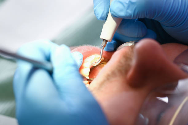 Best Emergency Denture Repair in Ridge, NY
