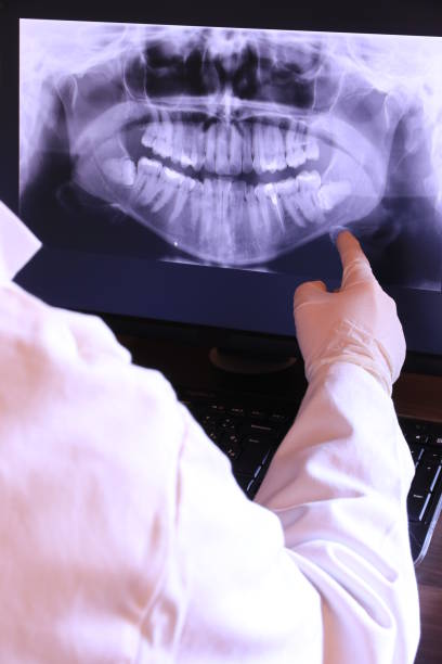 Best Emergency Dental Care for Broken or Chipped Teeth in Ridge, NY